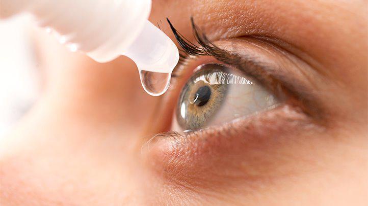dry eye